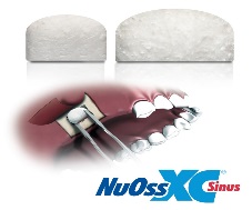 NuOss XC Sinus – 22 x 12mm